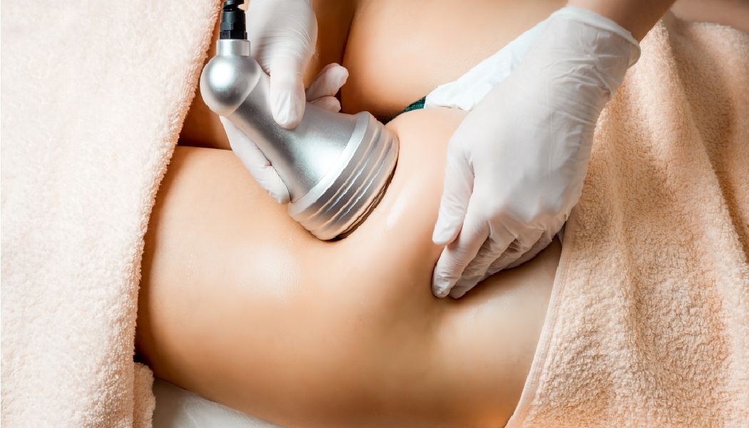 Laser Cellulite Treatment Dripping Springs