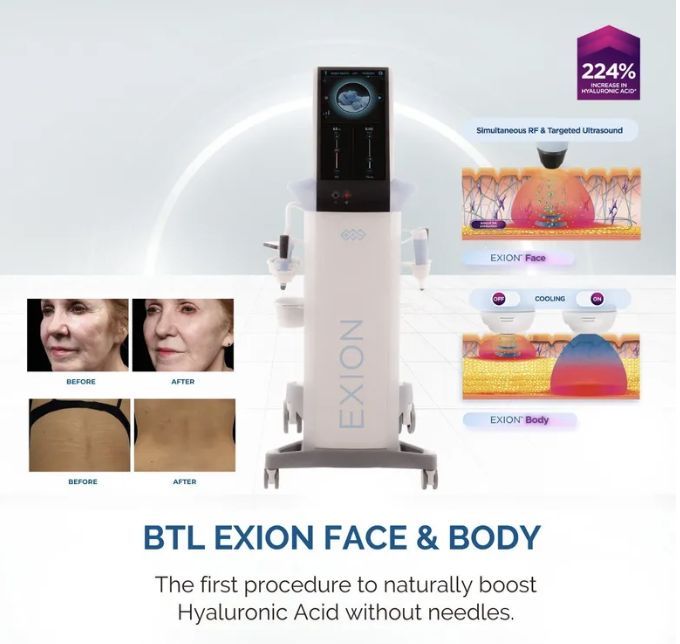 BTL EXION Face & Body device used for RF microneedling and skin tightening at Opal Aesthetics & Wellness